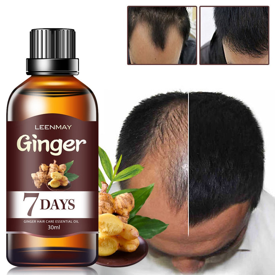 Rapid Growth Hair Essence/7 Days Fast Hair Growth Essence Oil/hair essence